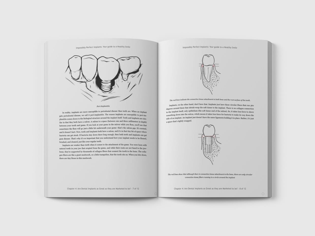 Dental Surgery