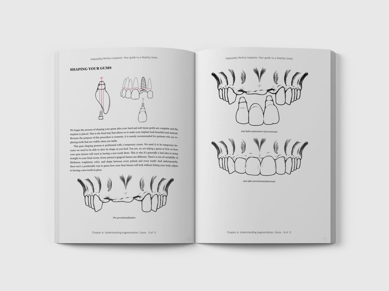 Dental Surgery